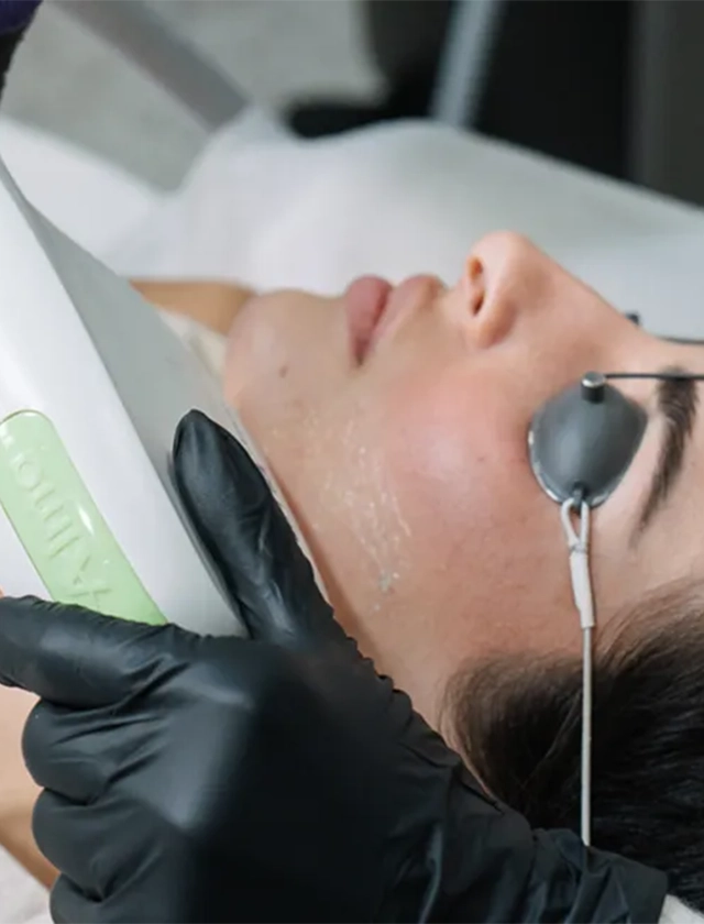 HIFU Ultraljud HIFU Ultraljud huduppstramning